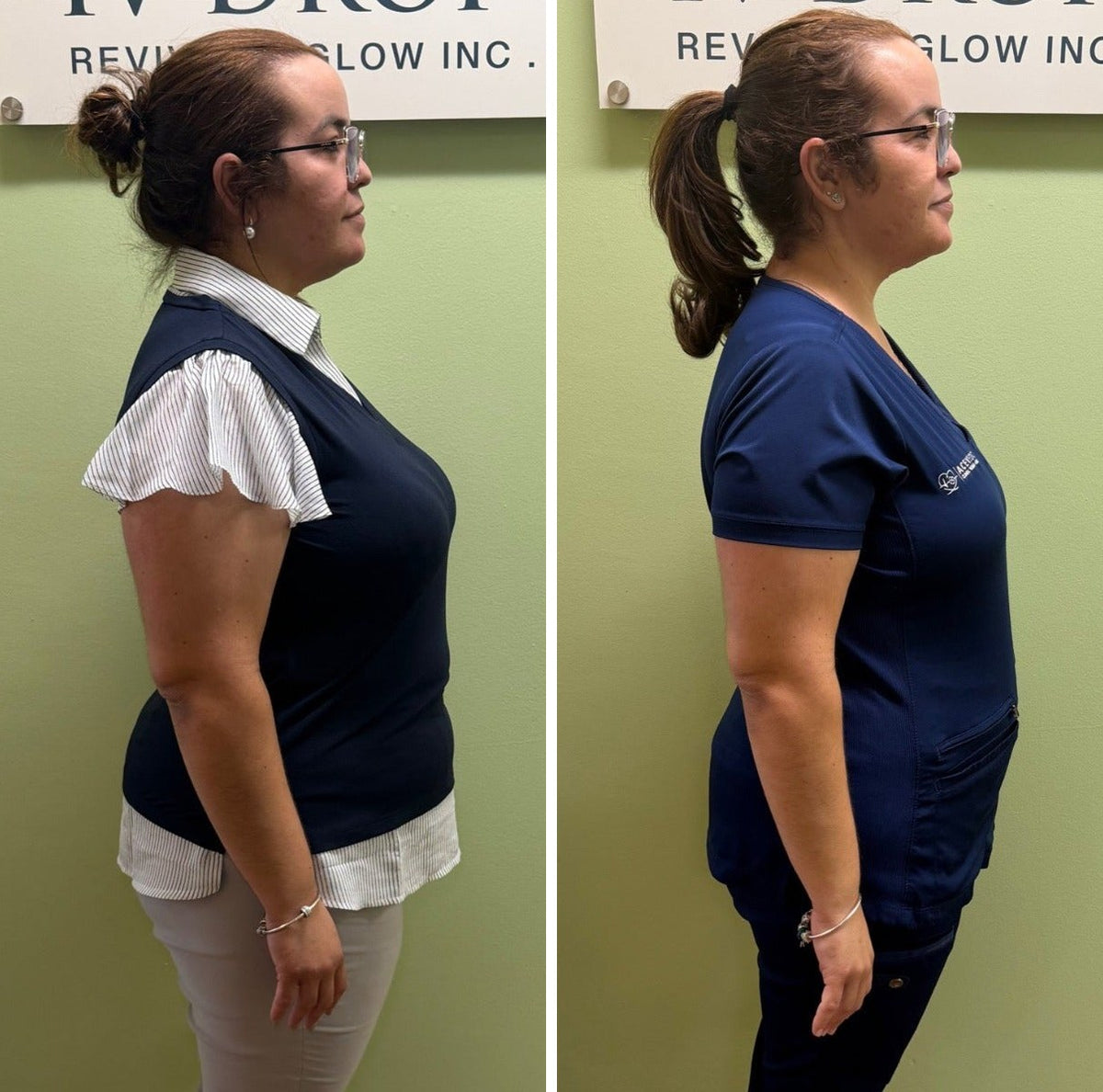 Medical weight loss before and after results at IV Drop Revival & Glow in Miami
